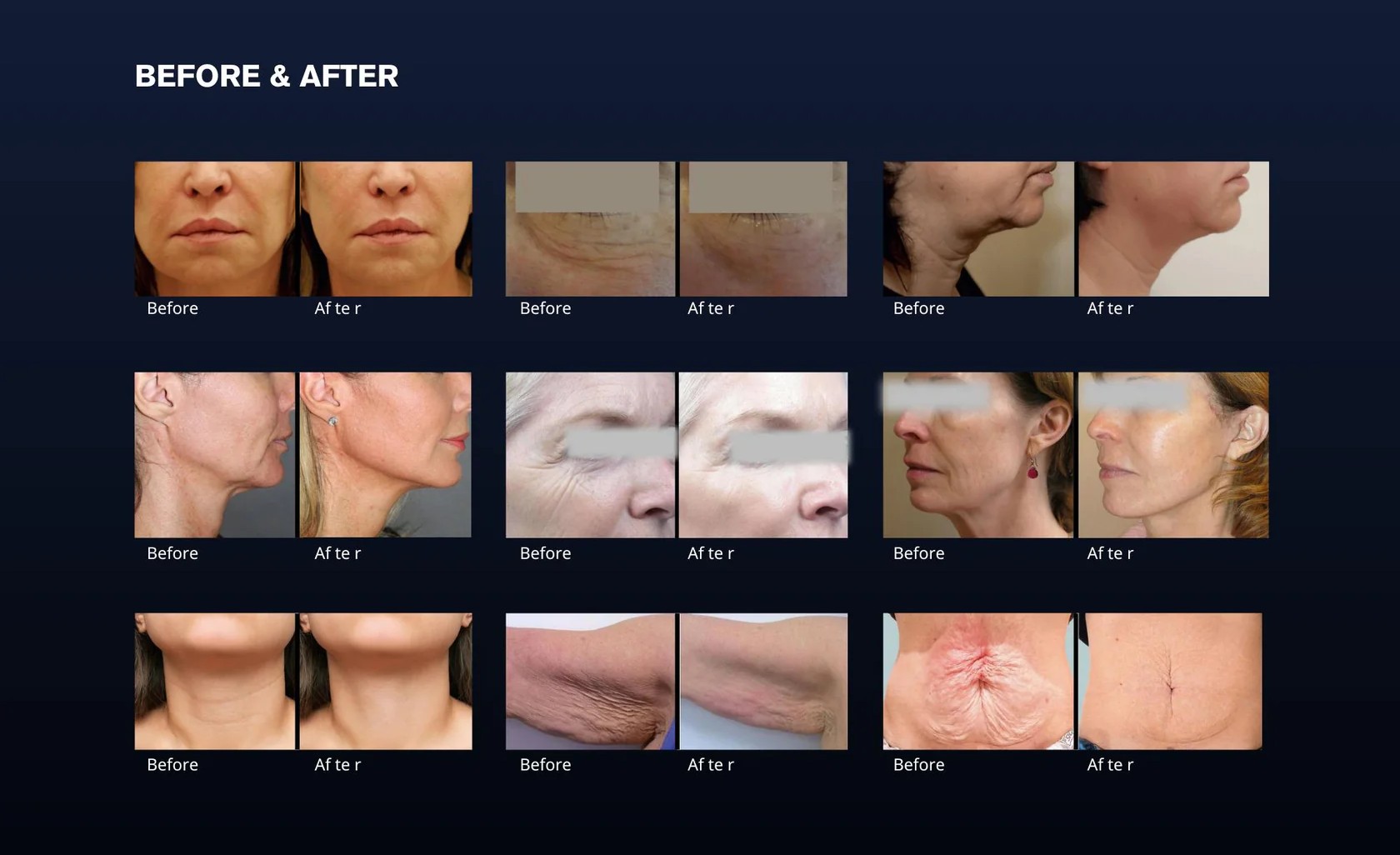 360° Vaginal Tightening – Safe, Gentle & Effective