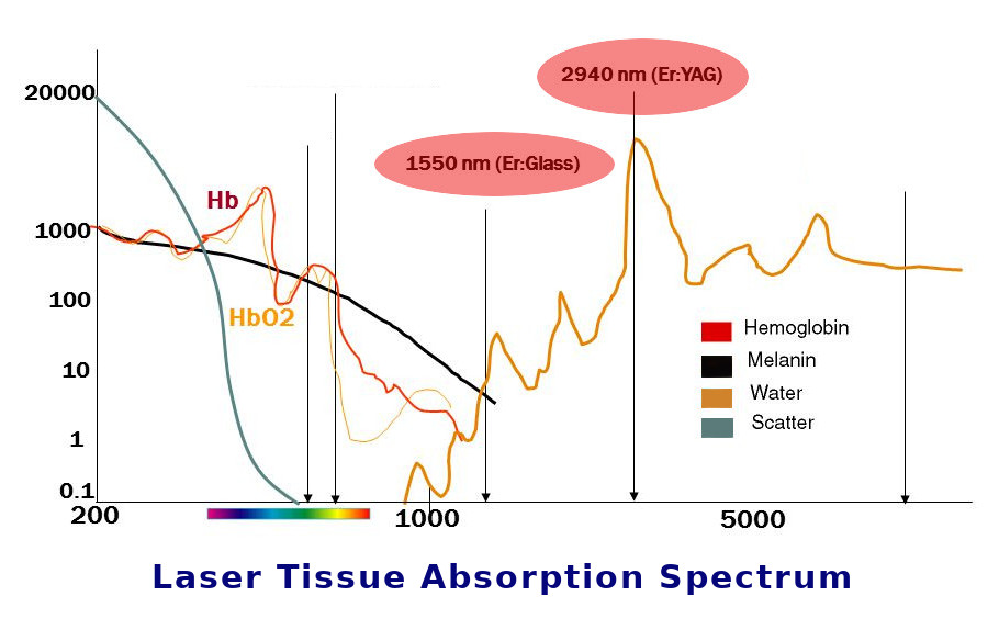1550nm Erbium Glass Laser